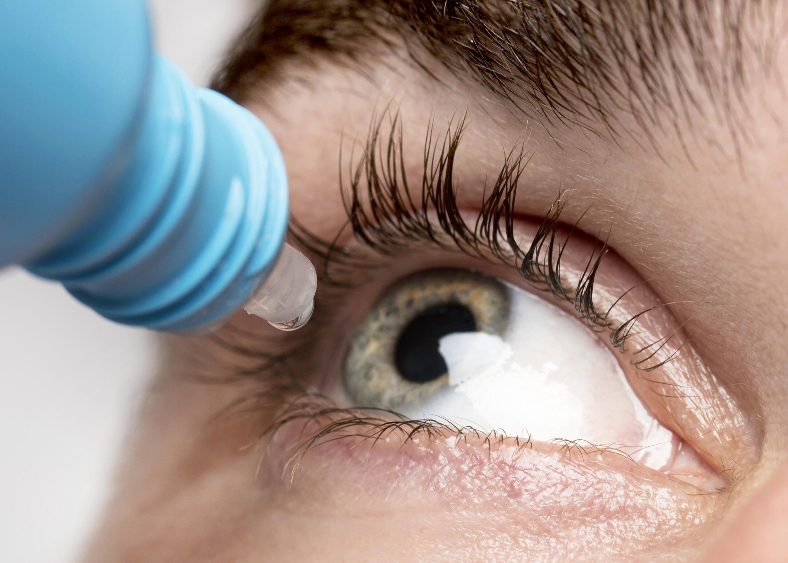 Corneal Transplant Surgery Guide | Eyemastr Dubai